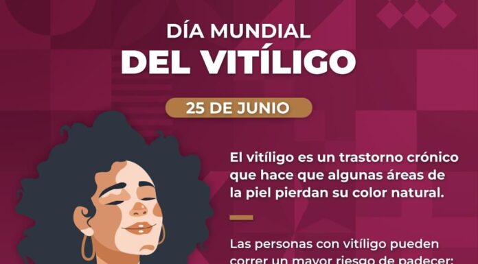 INVITAN A POBLACIÓN A DETECTAR OPORTUNAMENTE EL VITILIGO
